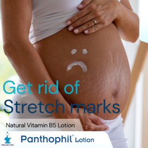 Pregnancy Stretch Mark Care